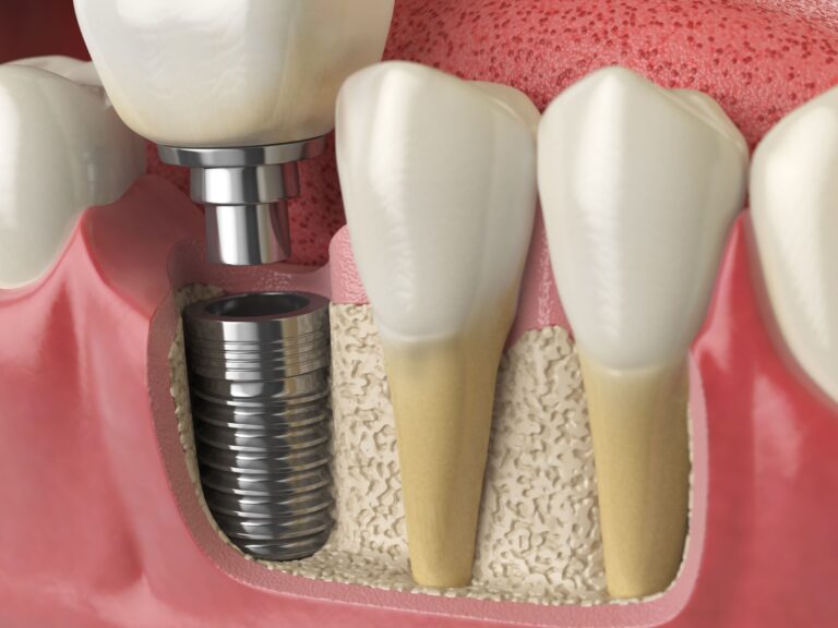 anatomy of healthy teeth and tooth dental implant 2021 08 26 16 56 57 utc 2 1 1