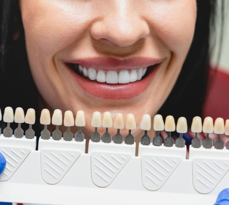 whitening concept dental care implants veneers 2021 12 09 04 23 39 utc 1 1