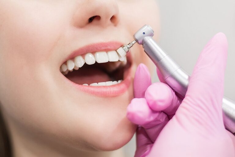 dentist brushes teeth young girl teeth whitening 2022 11 15 05 20 50 utc 1