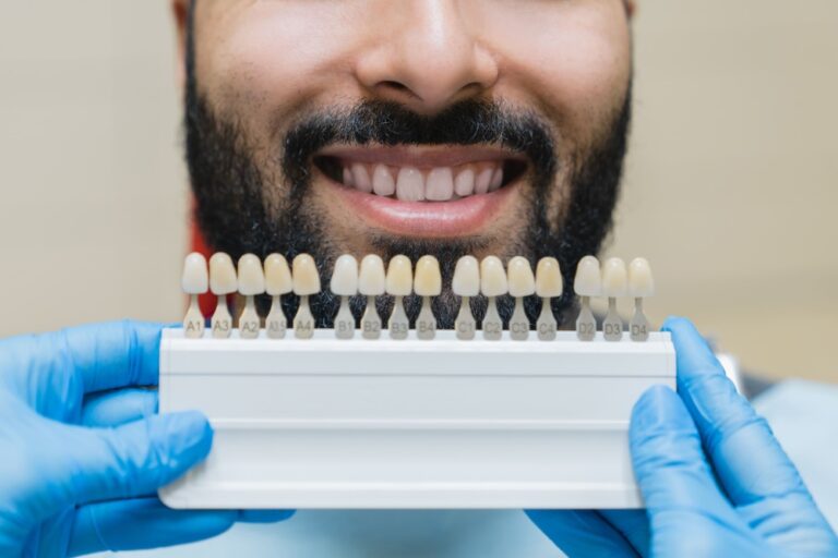 tooth teeth tone palette stomatologist choosing c 2021 12 09 04 24 55 utc 2